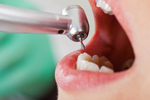 Best Emergency Dental Care for Broken or Chipped Teeth in Mammoth, AZ